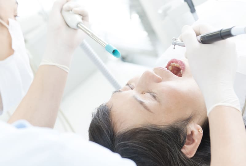 一般歯科のイメージ